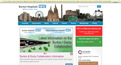 Desktop Screenshot of burtonhospitals.nhs.uk